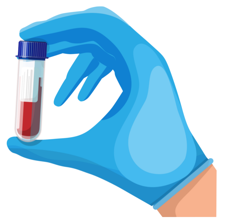 Lateral Flow Immunoassay